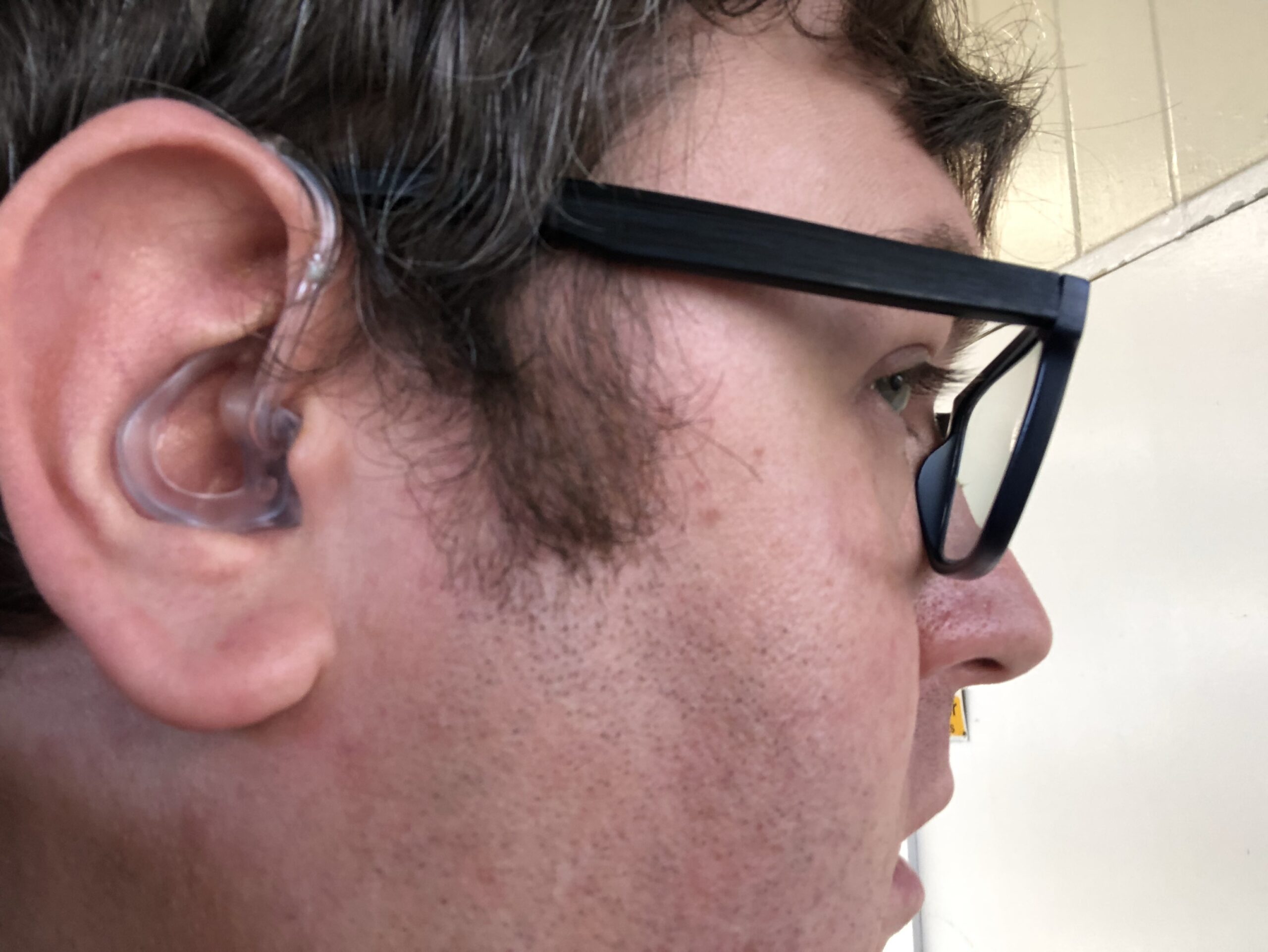 A photo of the side of my face, showing one of my hearing aids